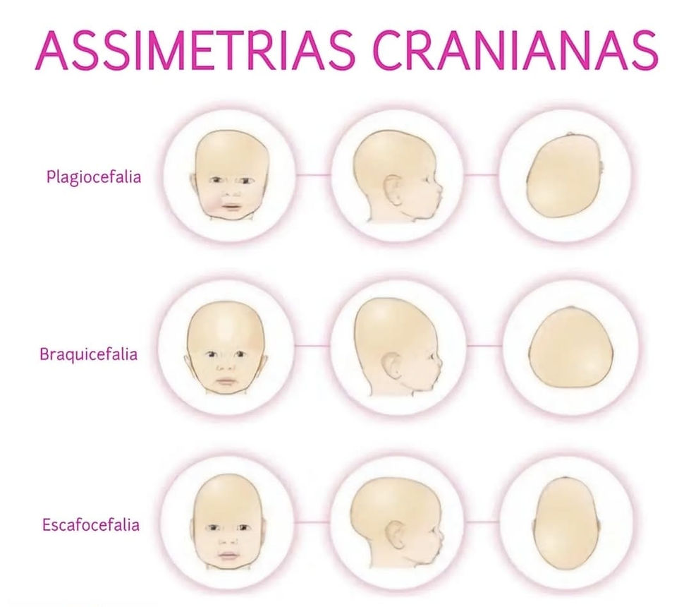 Assimetria Craniana | Clínica Habilito